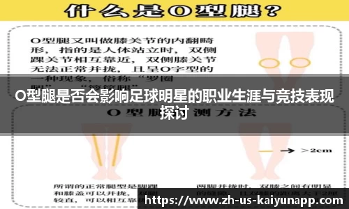 O型腿是否会影响足球明星的职业生涯与竞技表现探讨